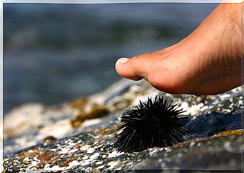 How to act when faced with a sea urchin sting